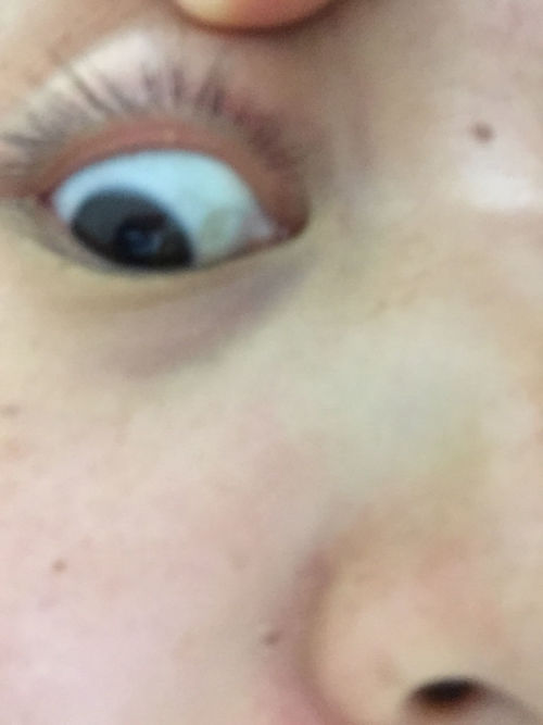 to8to.com(眼睛周围长得这些小颗粒,到底是什么啊啊啊啊?) to8to.com(眼睛周围长得这些小颗粒,到底是什么啊啊啊啊?)