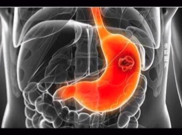 博仕(黄石博仕肛肠医院过度医疗追踪：手术率超90%，术中更换高价耗材)